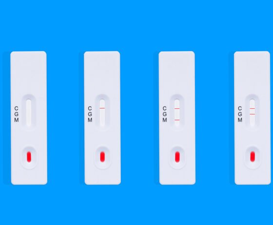 Understanding Rapid Tests: Fast and Convenient Medical Tools